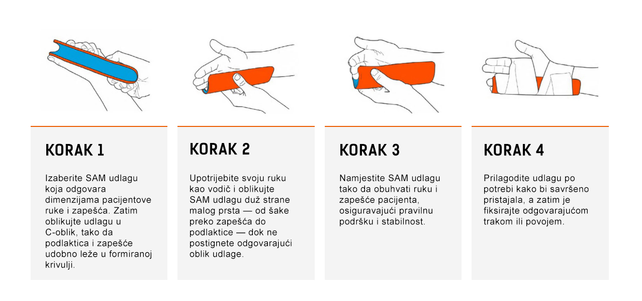 Fleksibilna udlaga Sam splint za imobilizaciju grafika