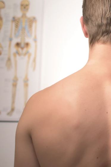 Kalcificirajući tendinitis ramena - Tko oboljeva i kako si pomoći?