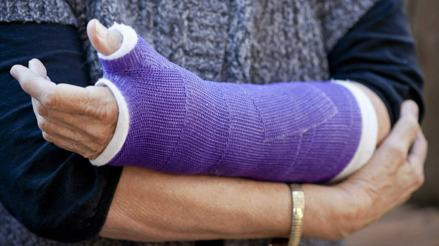 plastic cast slika za članak